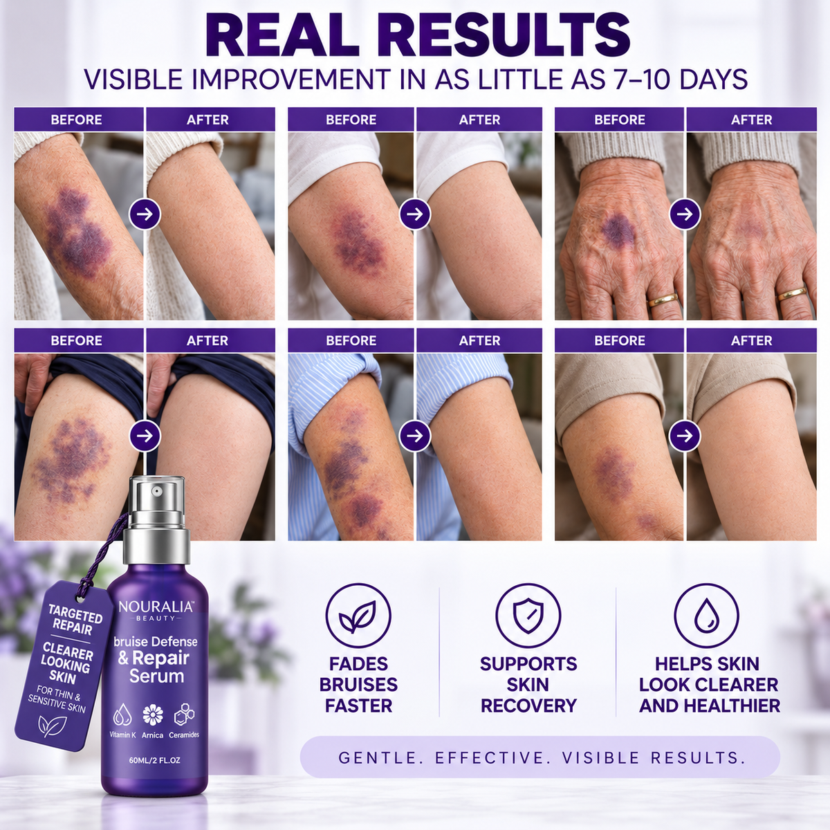 Bruise Defense & Repair Serum