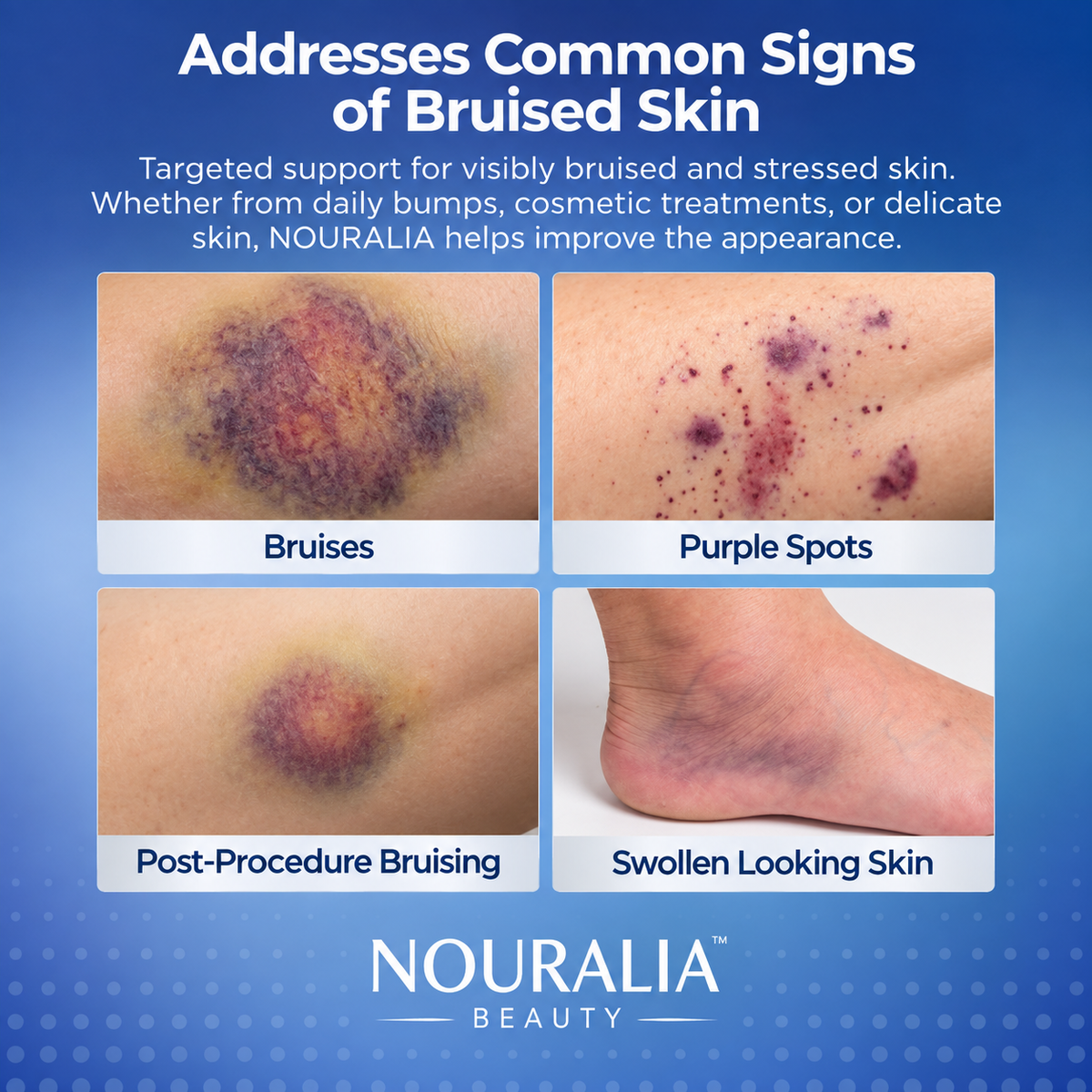 Bruise Defense & Repair Serum